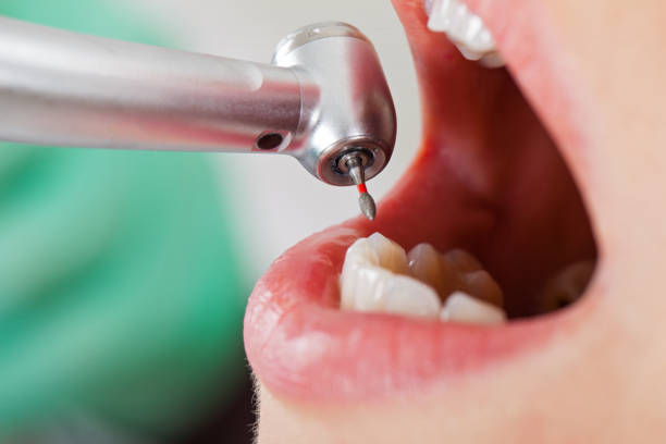 Best Emergency Gum Treatment in Henderson, GA